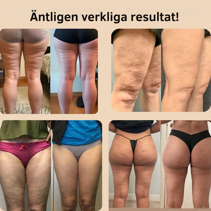 3D anti-cellulit shorts
